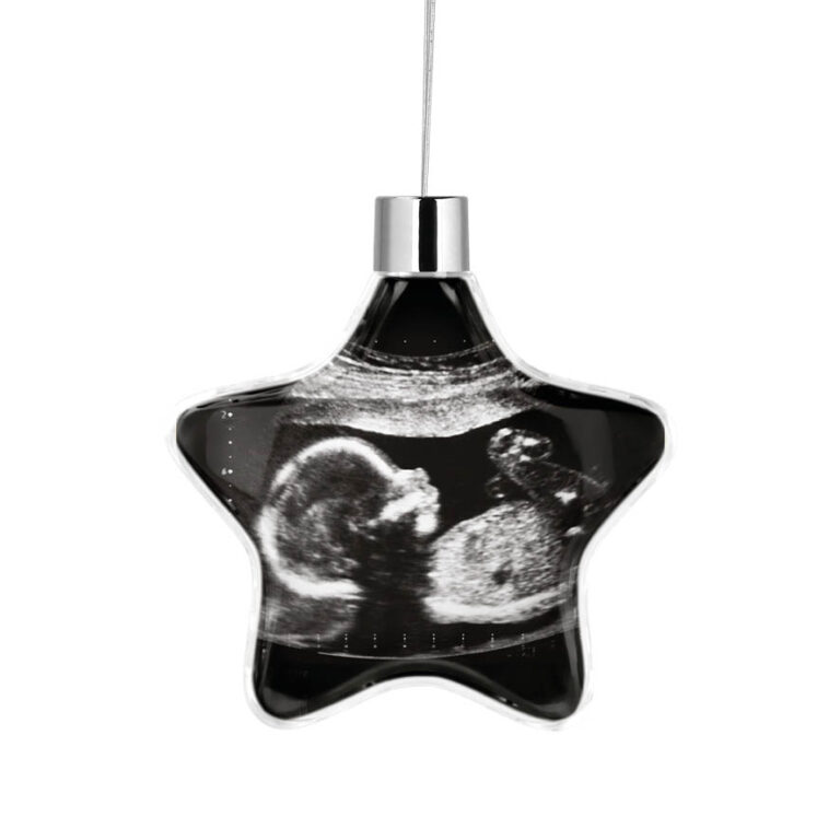 Αστέρι “Baby Loading υπερηχογράφημα”